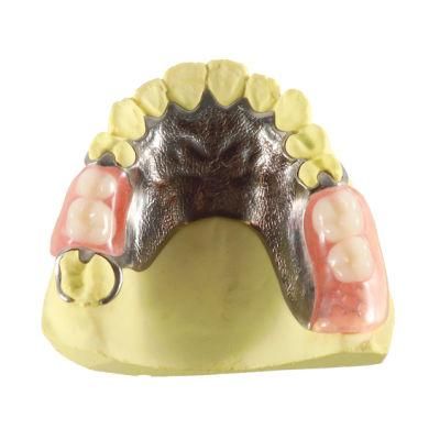 Dental Partials Printed by Metal 3D Printer M2150X