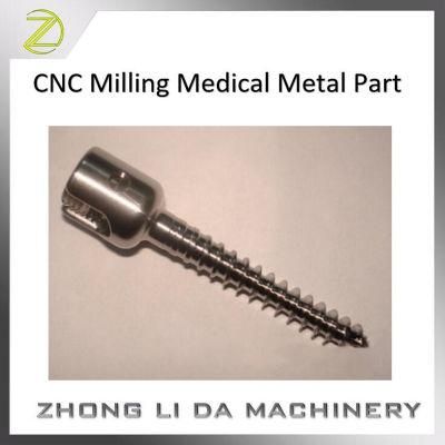 Custom CNC Milling Medical Metal Part